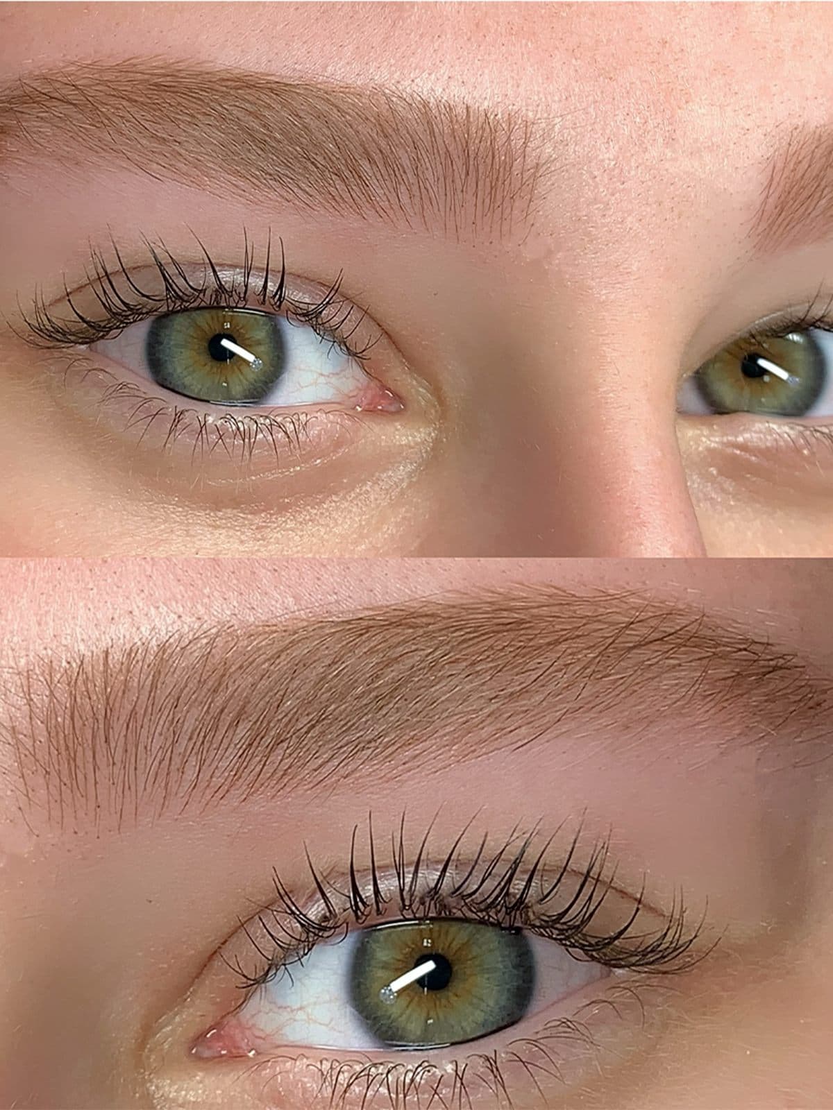 Antes e depois de sobrancelhas micropigmentadas, com as falhas preenchidas