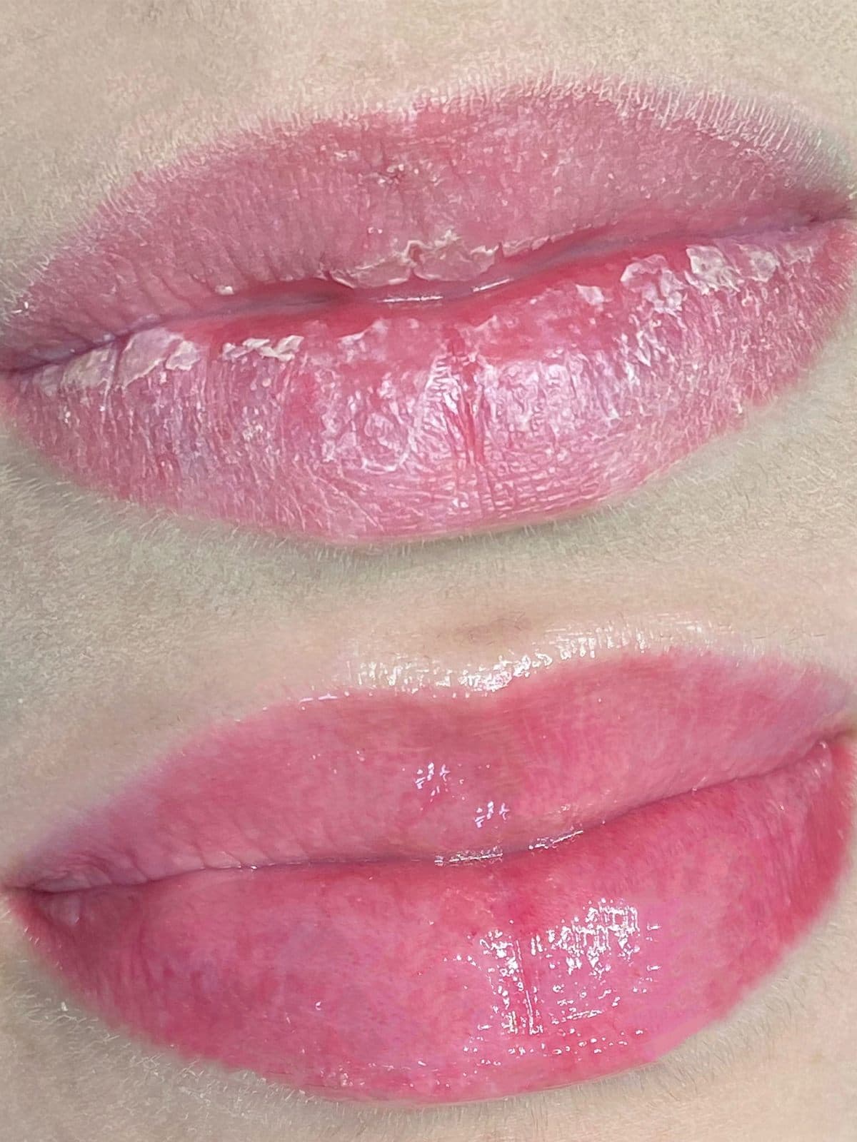 Antes e depois de micropigmentação labial com acabamento hidratado